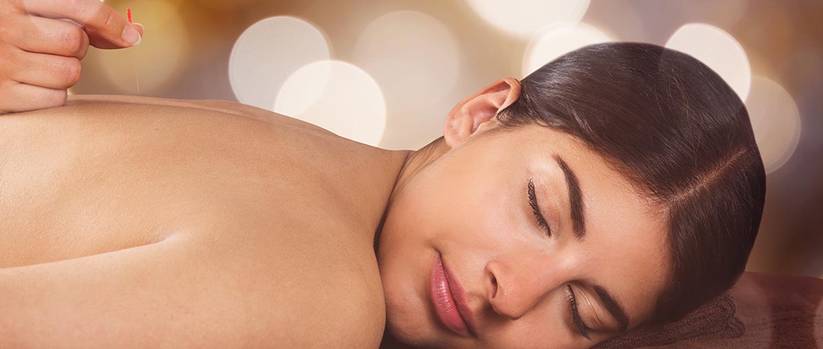 Acupuncture